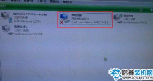 本地连接连不上 本地连接连不上